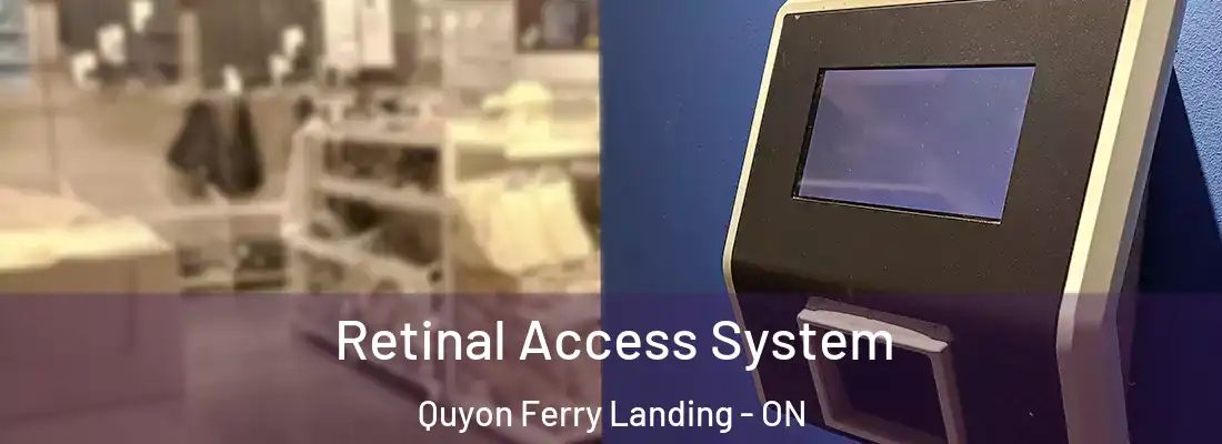  Retinal Access System Quyon Ferry Landing - ON